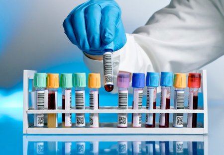 Ebolanın dərmanı koronavirusun da qarşısını ala bilər?